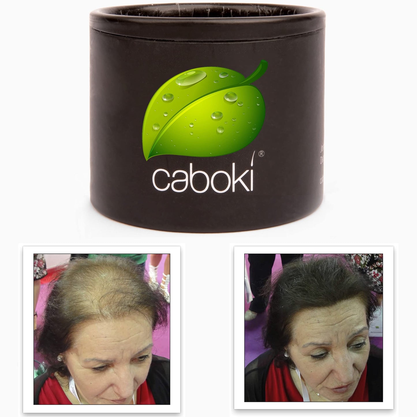 Hair Loss Concealer. Cover Bald Spot And Thinning Hair Instantly. Make Thin Hair Look 10X Fuller. All-Natural Hair Building Fibe